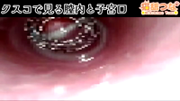 nekonametuna