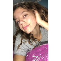 Tiktok amateur hidden candid ip cam ipcam tm Billie Eilish goon pyt 2