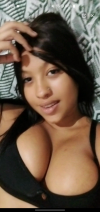 22856429