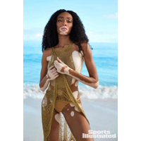Winnie Harlow